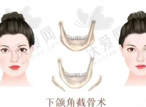 深圳非凡医疗美容医院收费标准参考