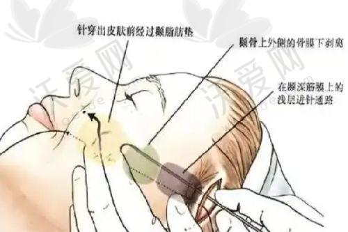 深圳非凡医疗美容医院地址