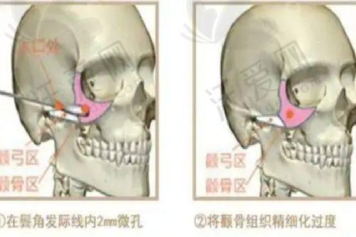 深圳非凡医疗美容医院电话号码
