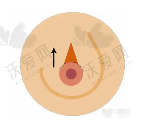 总结评价——深圳非凡医疗美容医院怎么样?