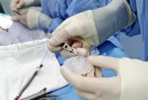 患者对爱尔眼科评价如何？