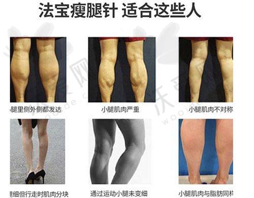 合肥维多利亚整形光子嫩肤的优质服务体验