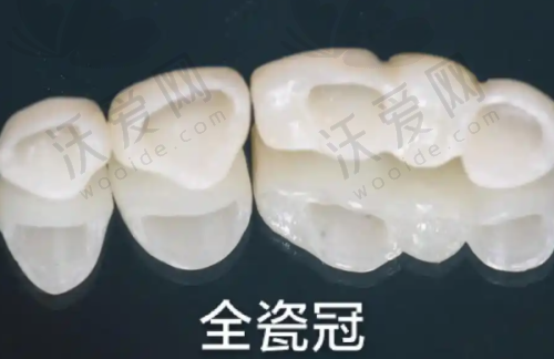 北京劲松口腔半口吸附性义齿的医生团队