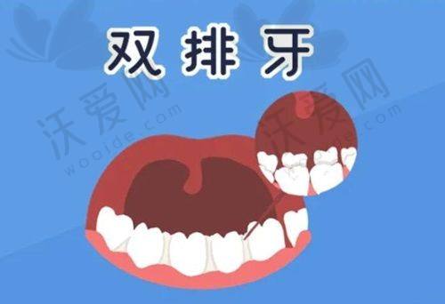 北京劲松口腔医院的其他收费标准参考
