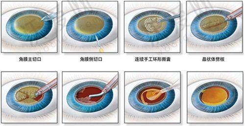 天水爱尔眼科医院地址在哪？交通路线全知道