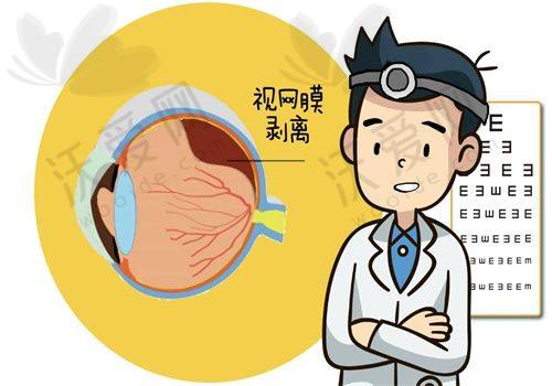 上海麦迪格眼视光中 心ICL晶体植入项目的原理是什么呢？