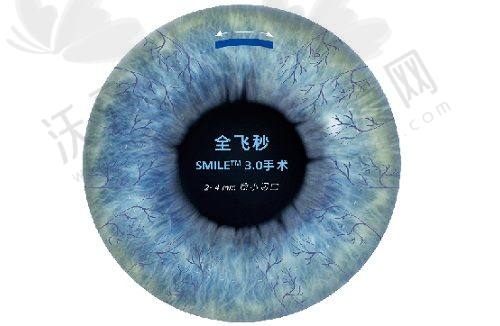 保定鹰华眼科白内障超声乳化吸除术7500元起/眼，名家主刀小切口速治白内障享医保