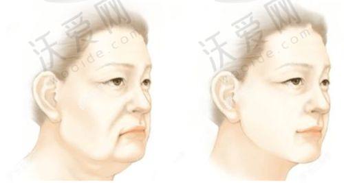 温州艺星整形医院其他项目收费标准参考