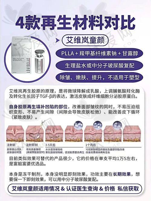 温州艺星整形美国曼托假体隆胸原价38800元，活动价格19800元起术后安心舒适