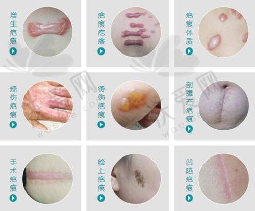 合肥维多利亚整形光子嫩肤，开启您的焕肤之旅