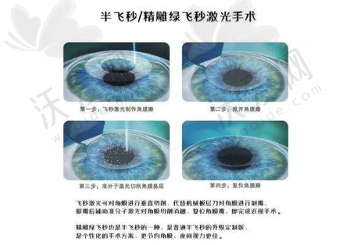 天水爱尔眼科医院干眼症舒缓原价2000元现168元起，享舒适有效技术