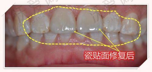 宜宾喜牙口腔医院营业时间