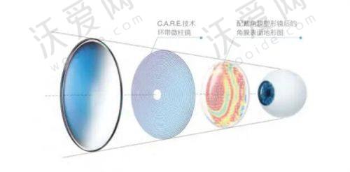 北京茗视光眼科医院全飞秒手术前后感受与变化