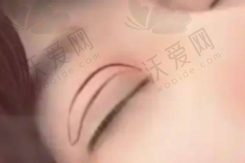 哈尔滨羽禅医美其他项目收费标准参考