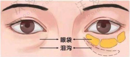 哈尔滨羽禅医疗美容自体脂肪面部填充原价36800元，现仅8888元起享自然饱满轮廓！
