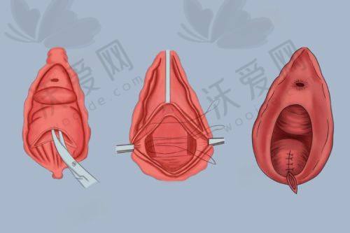 洛阳孔繁荣医美丝丽516+AOPT超光子全模式的技术优势