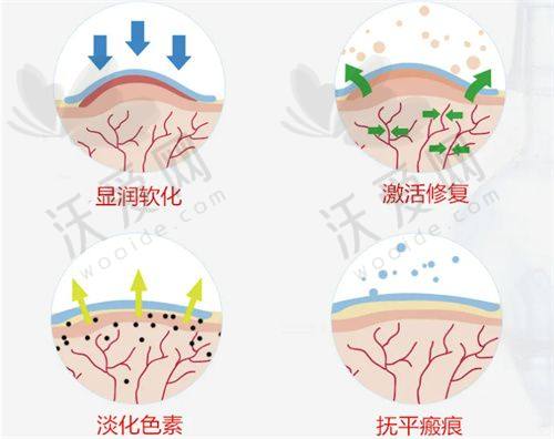 成都莱瑞拉威塑医疗美容医院黄佳涌医生口碑评价如何？