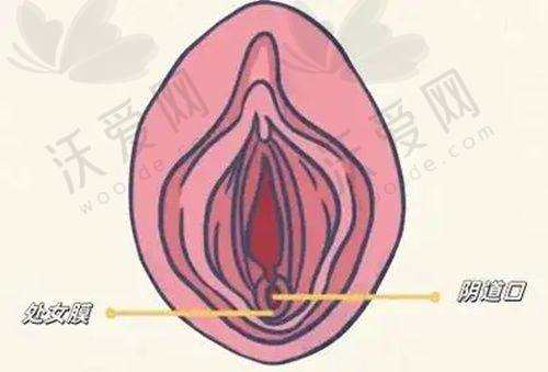 南宁芭芘丽医美桃花瓣性感M唇的作用和成效