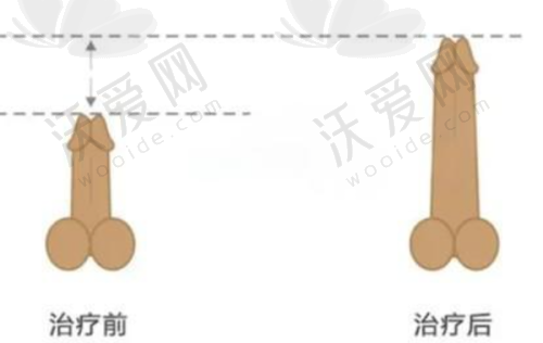 总结——山东烟台曙光医疗美容医院聂瑞峰医生怎么样？