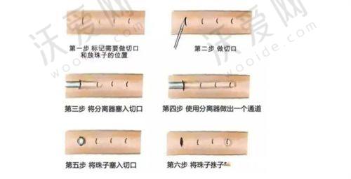 总结——成都莱瑞拉威塑医疗美容医院黄佳涌医生怎么样？
