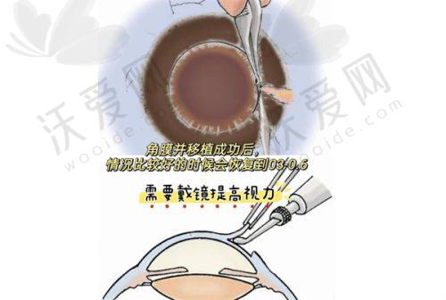 昆明康特森眼科医院体检项目怎么样？