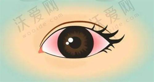 佛山高明爱尔眼科医院评价