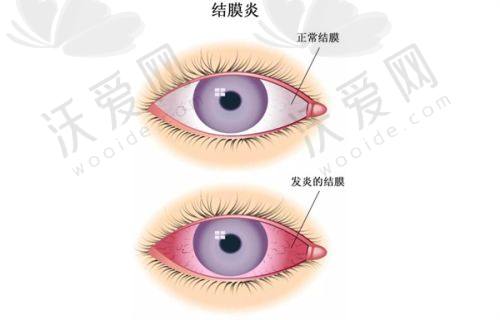 商丘普明眼科医院（柘城眼科医院）电话号码
