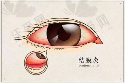 深圳普瑞眼科深层干眼SPA165元起，显著改善眼况还你水润清晰视界