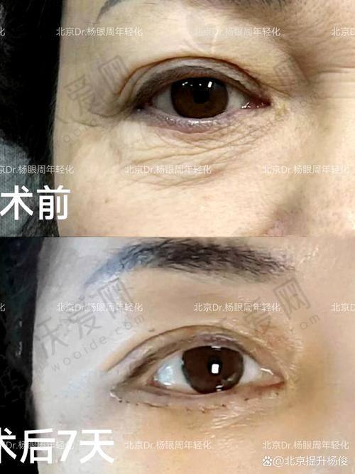 总结评价——诸暨西子医疗美容医院怎么样？