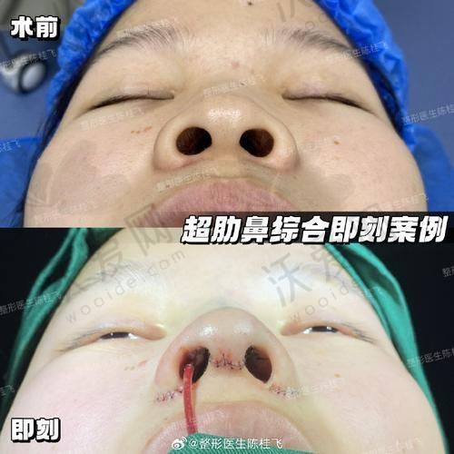 湖州恒颜美医疗美容门诊部收费标准参考