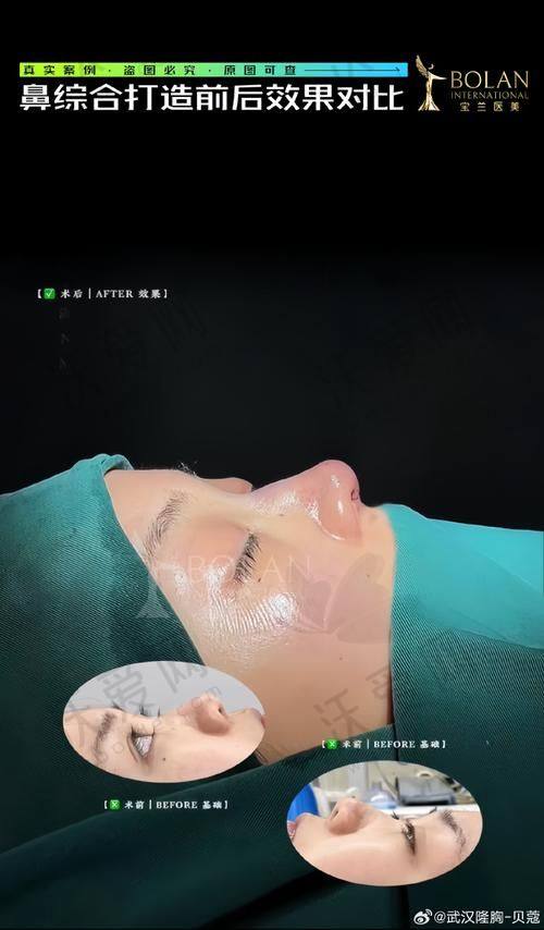 诸暨西子医疗美容医院地址