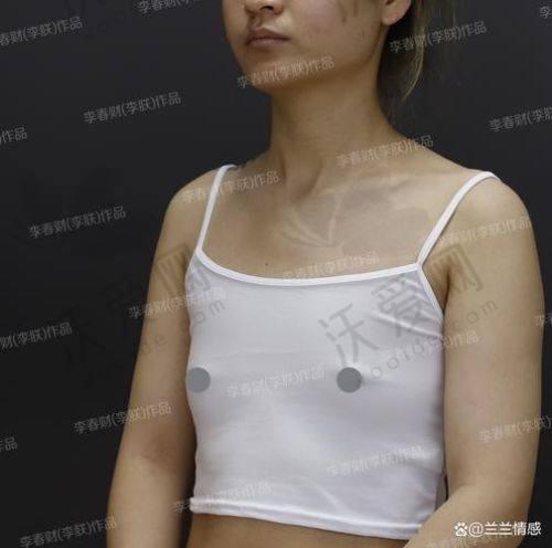 深圳非凡医疗美容医院林茂辉医生口碑评价如何？