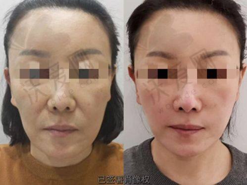 诸暨西子医疗美容医院技术好不好？