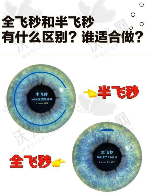 天水爱尔眼科医院半飞秒手术技术实力雄厚