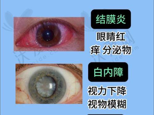总结——安徽合肥沃瑞眼科医院李旭辉医生怎么样？