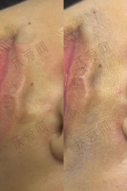 哈尔滨羽禅医疗美容其他项目收费标准参考