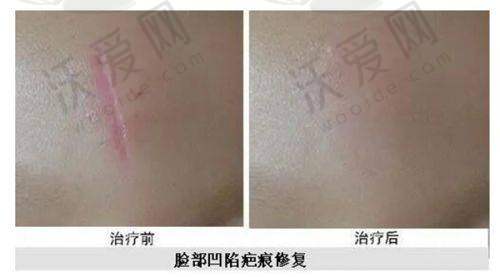 福建泉州西华医疗美容门诊部谢占军 医生技术好不好？