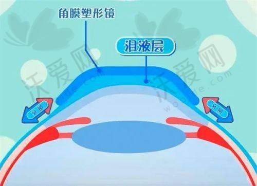 成都龙泉驿欧普眼视光眼科门诊部硬件设备精良！