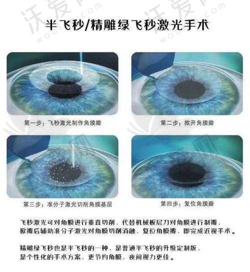 南京新视力眼科诊所电话号码