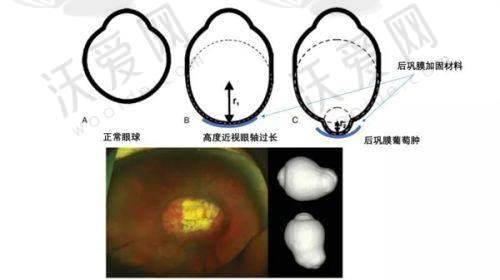 成都龙泉驿欧普眼视光眼科门诊部地址