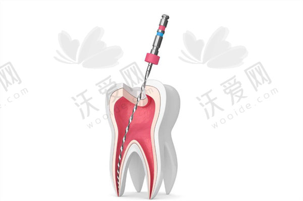 兰州皓亚口腔前牙根管治疗原价630元现199元起，数字化技术助您重享好牙体验！