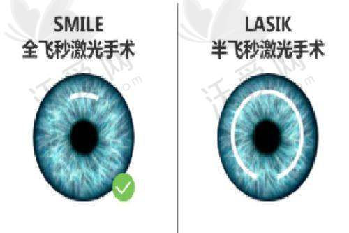 郑州美视美康眼科医院正规吗？地理位置与交通便利性考察
