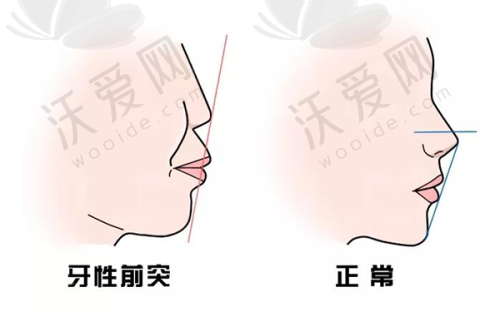 深圳福雅医疗美容博乐达水杨酸刷酸的服务保护
