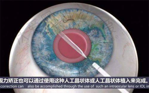 嘉兴爱尔眼科医院的服务质量