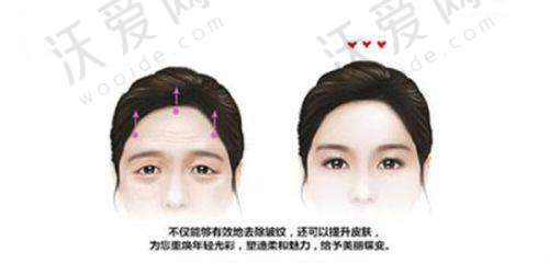 呼和浩特紫洁医疗美容医院史秋宇医生技术好不好？