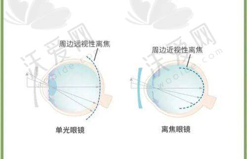 天水市第一人民医院眼科OK镜/青光眼/眼底病价格表：学生党有隐藏补贴
