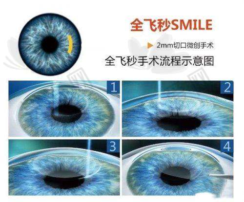 新疆医科大学第一附属医院眼科设备与技术配置