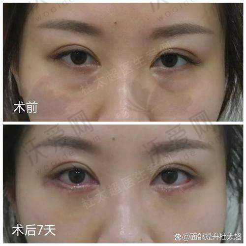 成都友谊整形医院本身有什么优势？