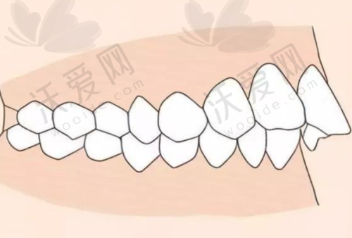 兰州齿语口腔门诊部技术好不好？