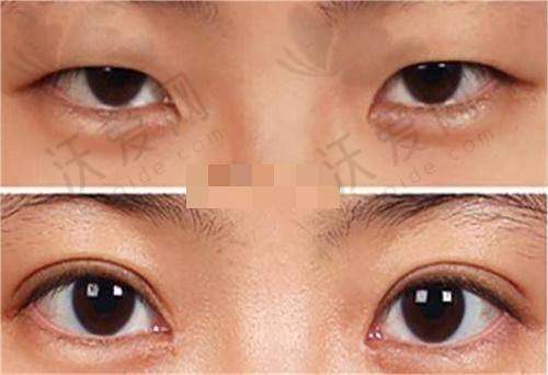 佳木斯韩艺来医疗美容医院伍远红医生口碑评价如何？